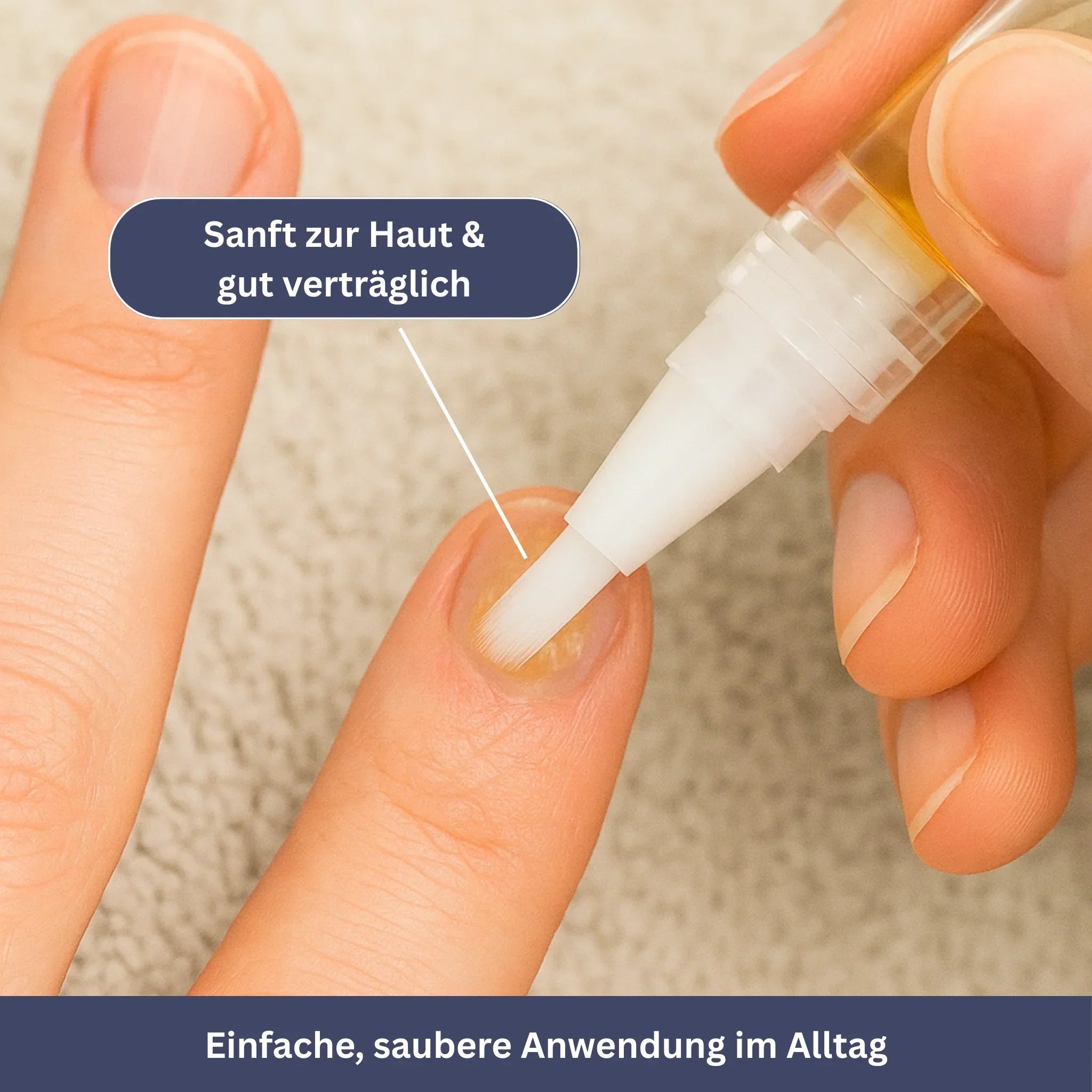 NailPen – Repair Pen for Nail Fungus & Inflammation