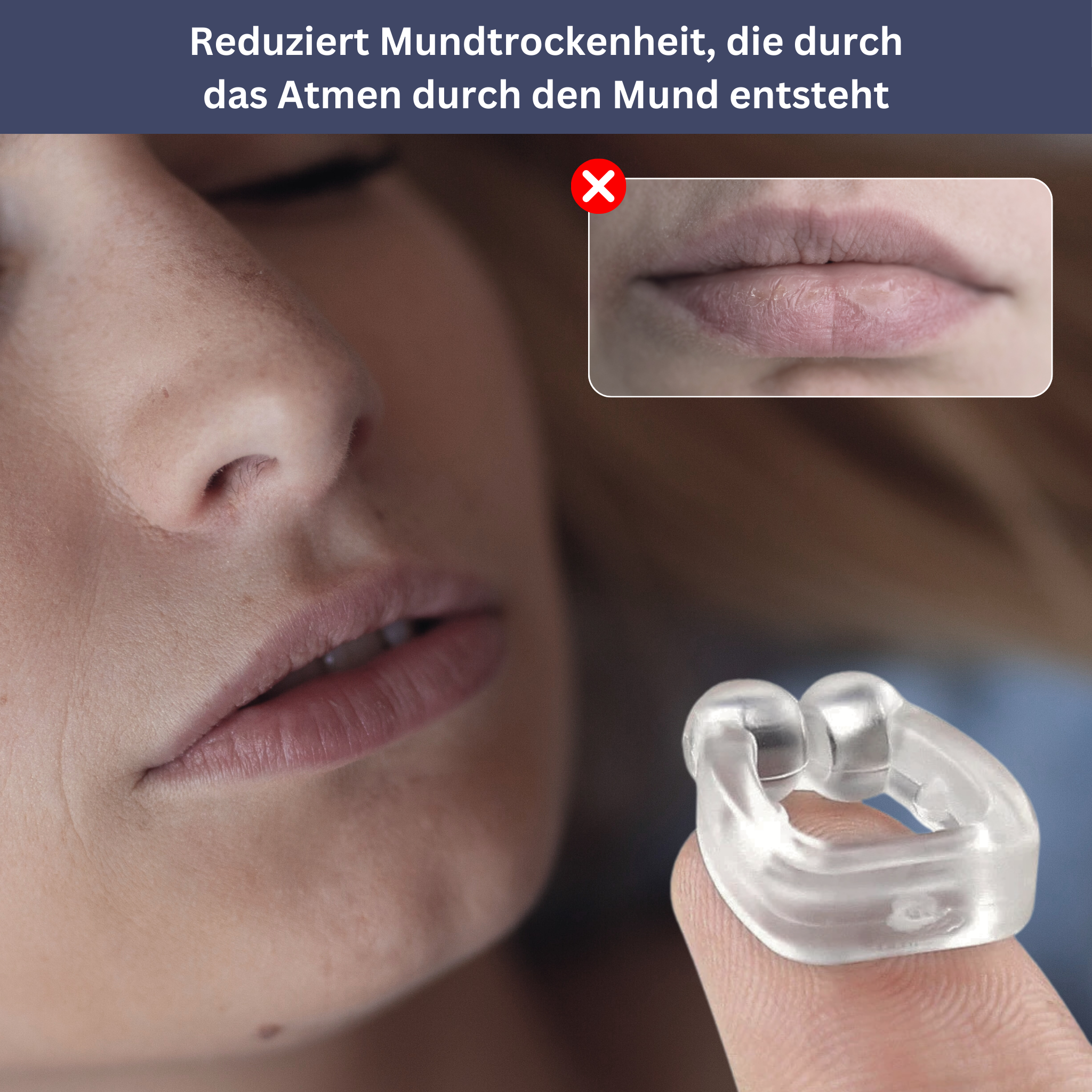 SilentBreeze – Magnetic Snore Stopper