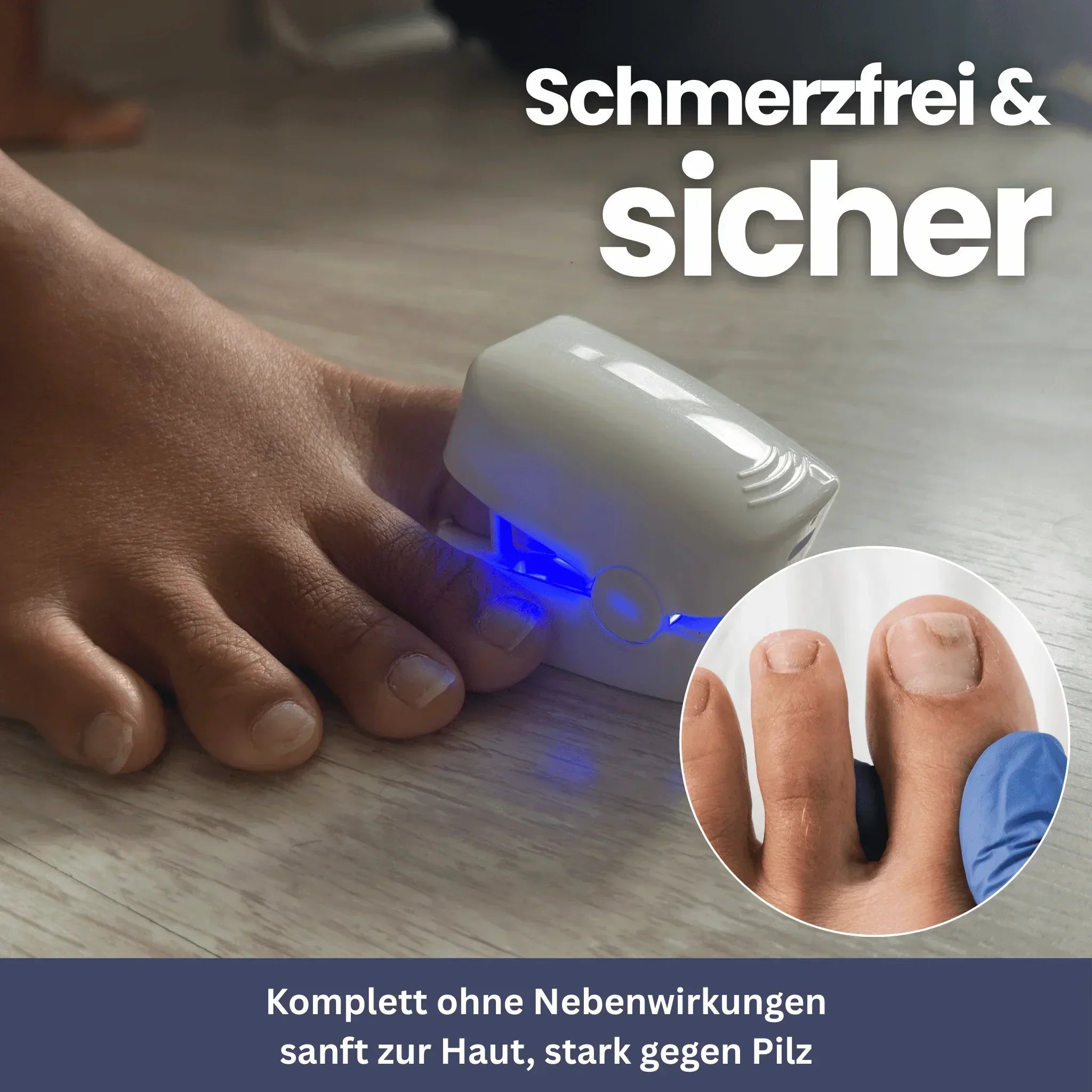NailClip - Nagelpilztherapie-Gerät