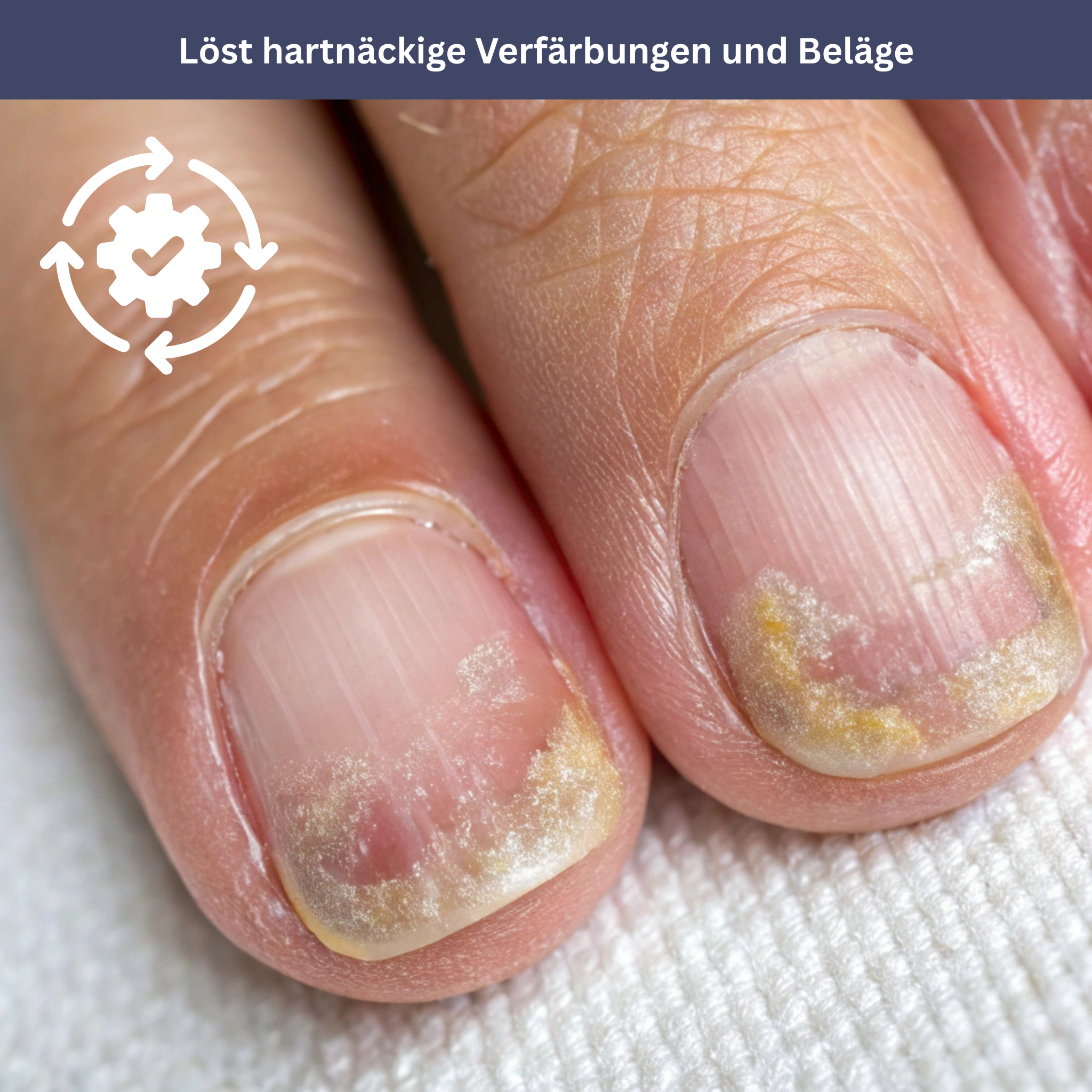 NailDrops - Pflegeserum gegen Nagelpilz