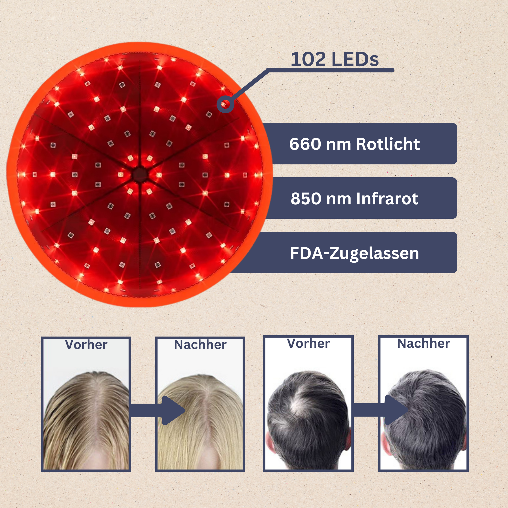 HairRevive Lichttherapie-Mütze