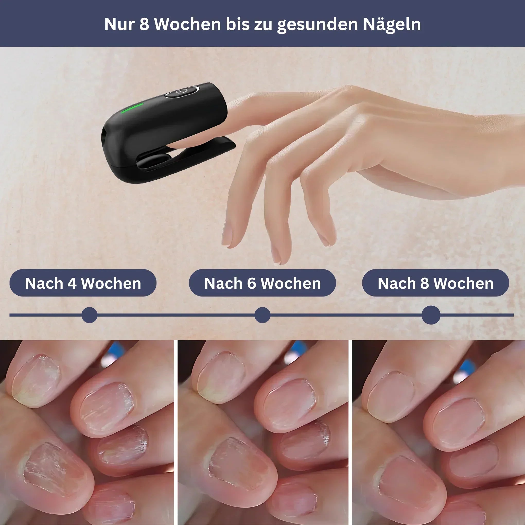 DermaClear Pro - Nagelpflegegerät zur Pilzreduktion & Reinigung