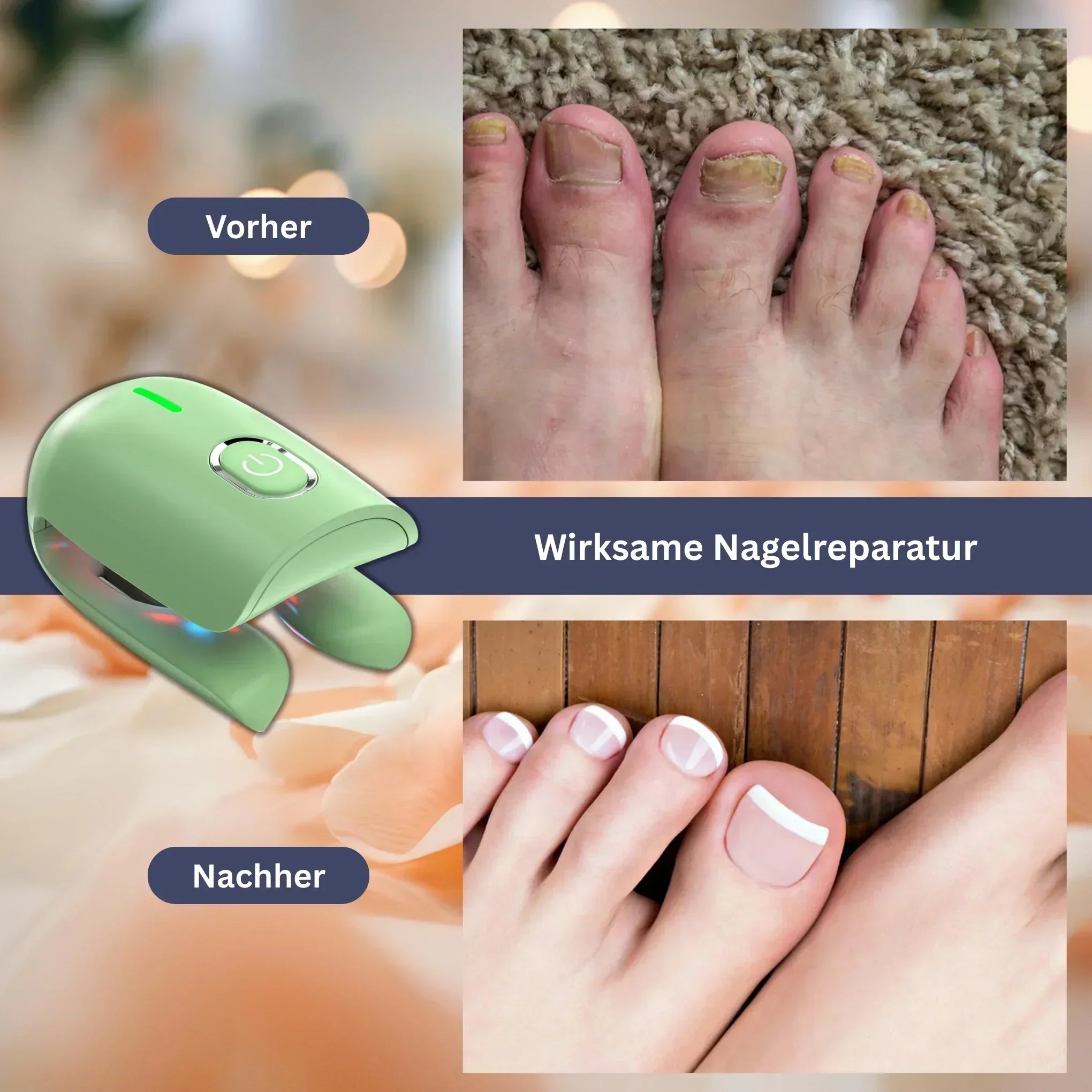 DermaClear Pro - Nagelpflegegerät zur Pilzreduktion & Reinigung