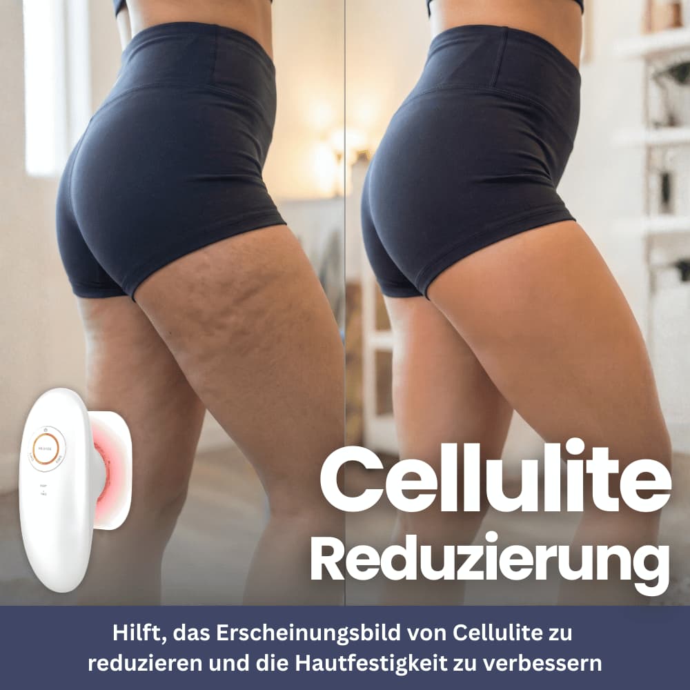 DermaLift Pro – Anti-Cellulite Massagegerät